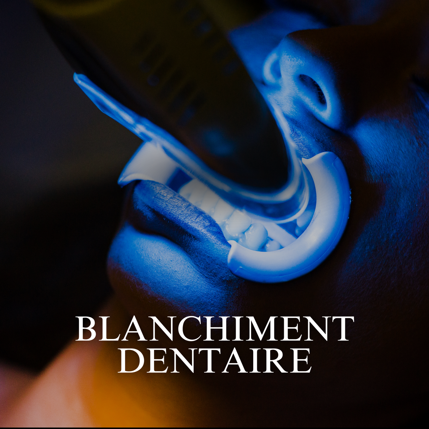 BLANCHIMENT DENTAIRE